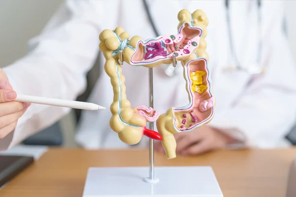 doctor pointing to a model of large intestine | Las Vegas Surgical Associates